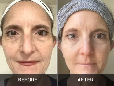 Promotional before and after pair two. Results not typical.