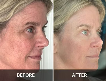 Promotional before and after pair three. Results not typical.